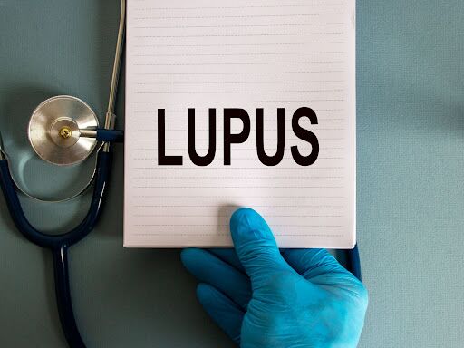 What is Lupus